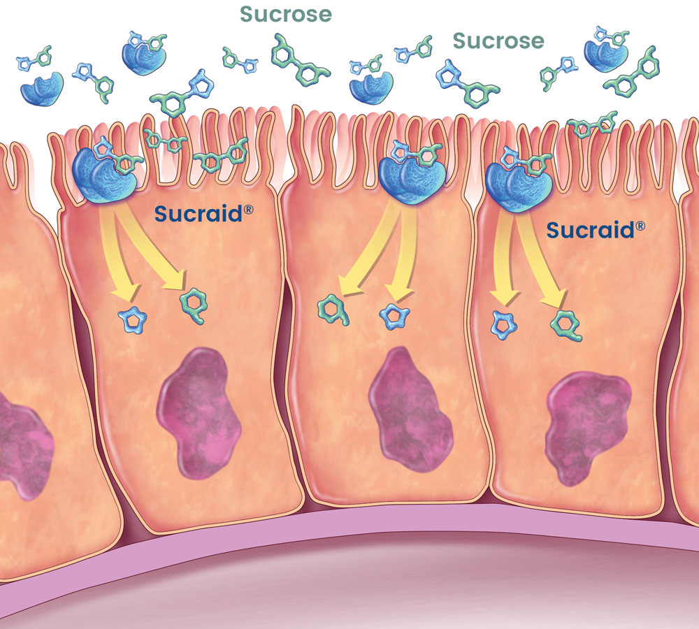 How Sucraid Works