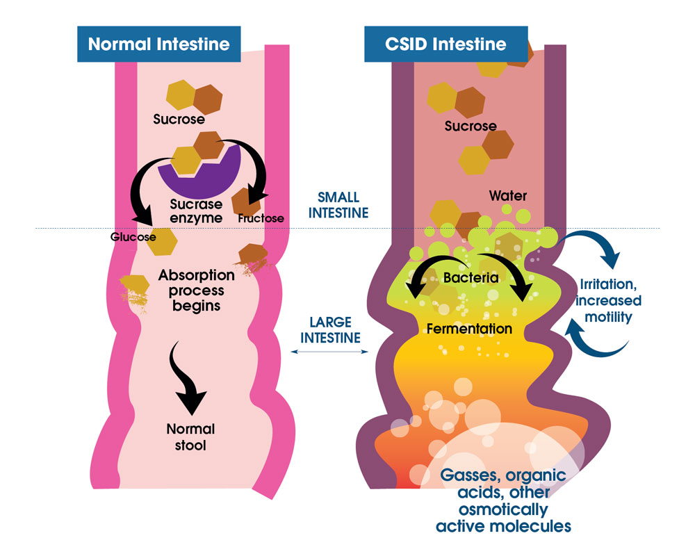 What is CSID